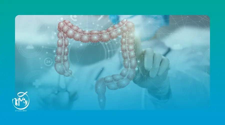أعراض سرطان القولون عند النساء
