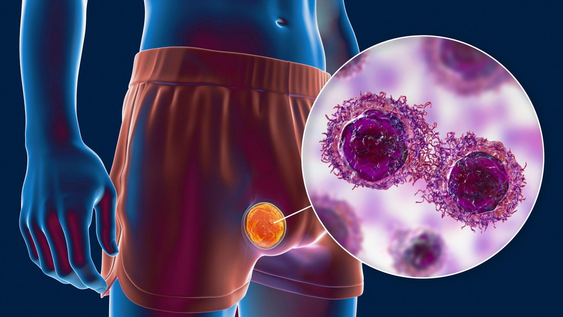 أورام الرأس والرقبة